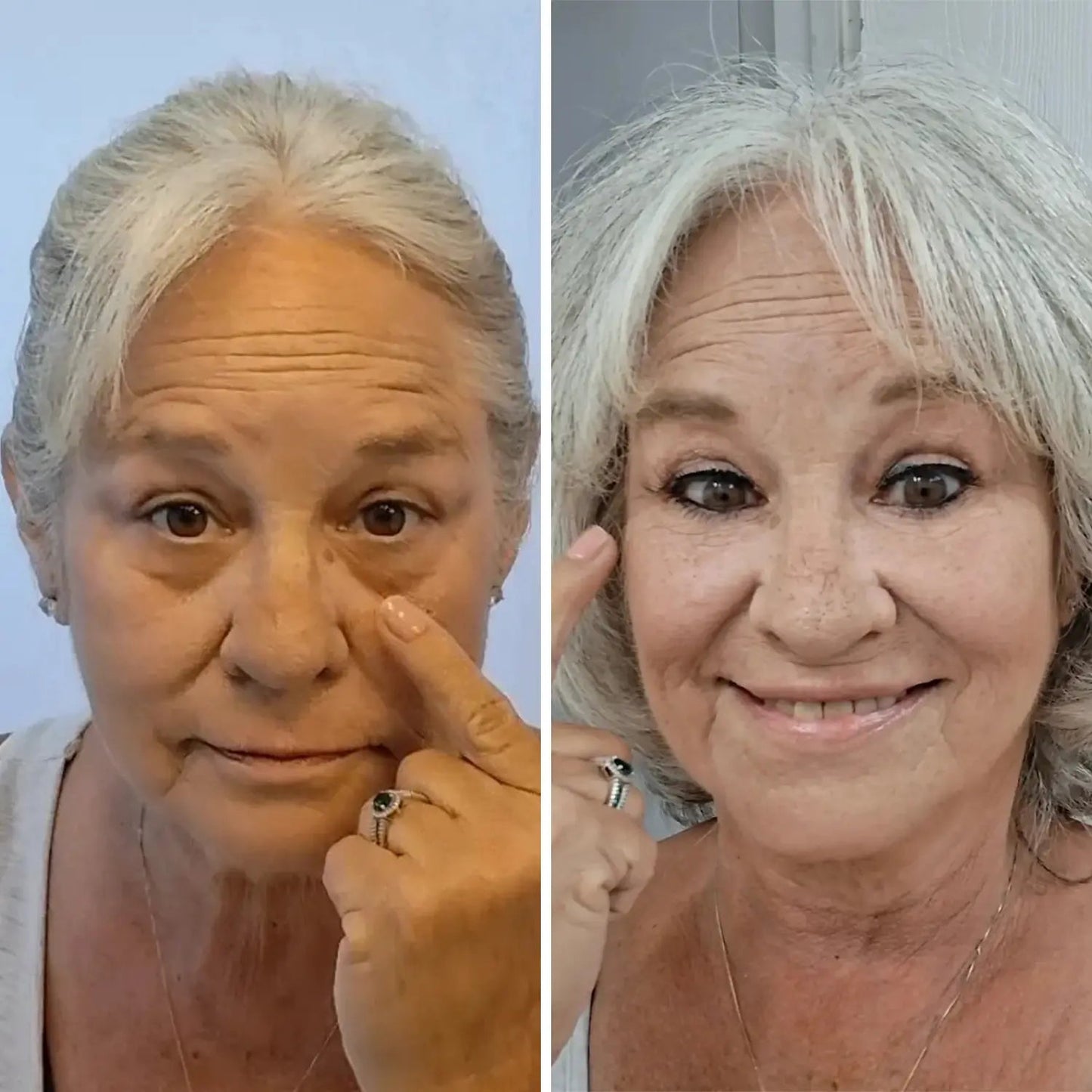 Undea solución para ojeras