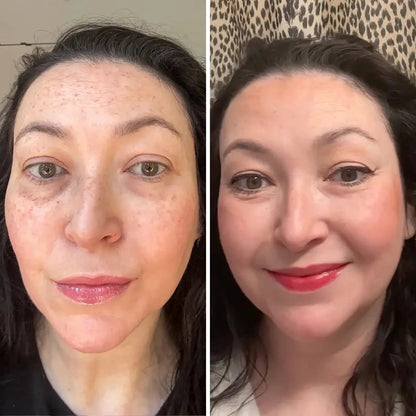 Undea solución para ojeras