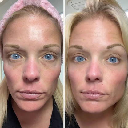 Undea solución para ojeras