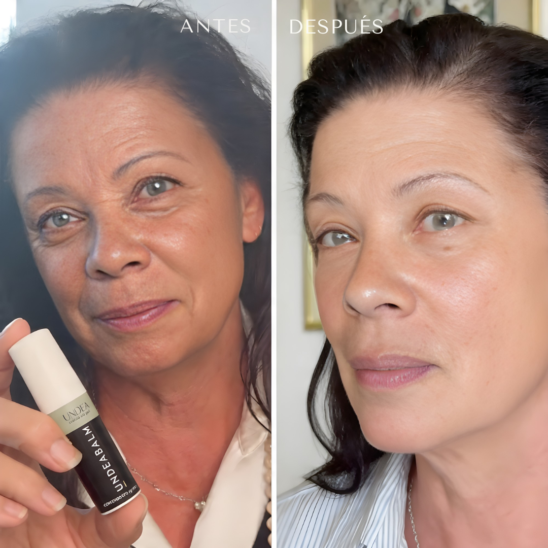 Undea solución para ojeras